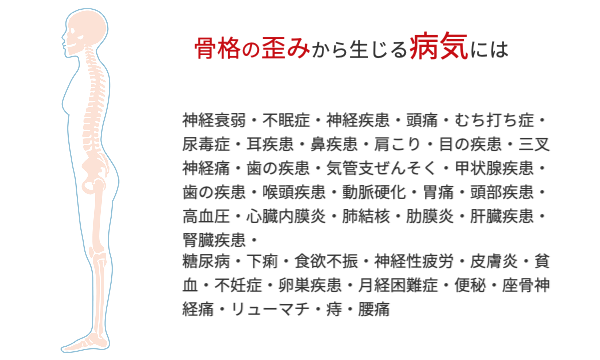 骨格のゆがみから生じる病気の一覧