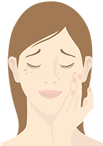 お顔に吹き出物ができている女性のイラスト